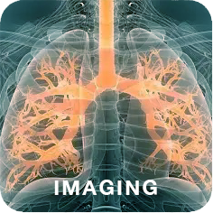 Square graphical button with a fake xray showing lungs and the word imaging vertically on the left